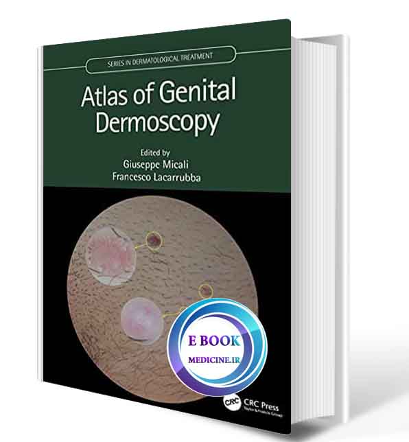 دانلود کتاب Atlas of Genital Dermoscopy (Series in Dermatological Treatment) 2021 (ORIGINAL PDF)